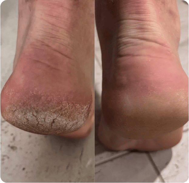 Le Crème© - Lavender + Lime Whipped Tallow Balm