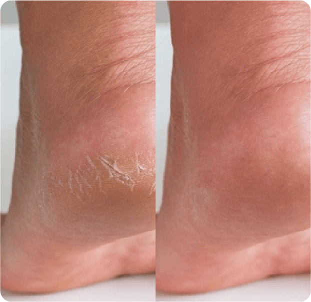 Le Crème© - Vanilla + Orange Whipped Tallow Balm