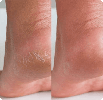 Le Crème© - Vanilla + Orange Whipped Tallow Balm