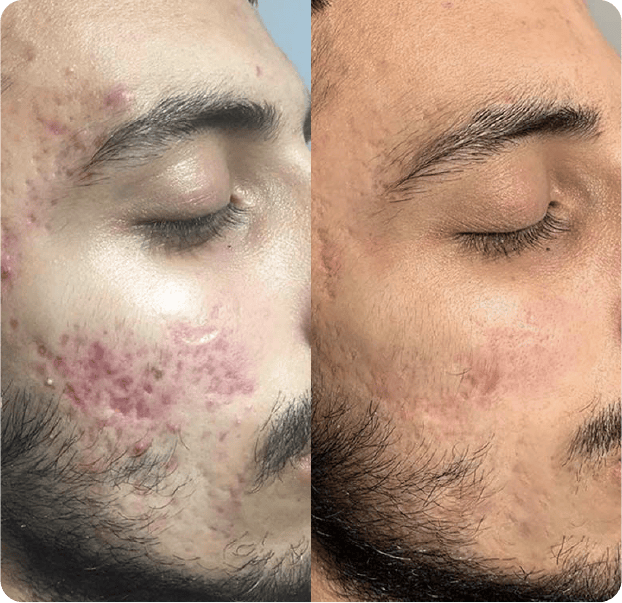 Le Crème© - Unscented Whipped Tallow Balm