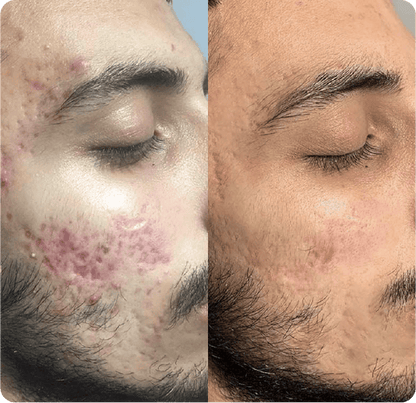 Le Crème© - Unscented Whipped Tallow Balm